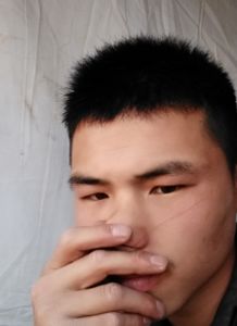 女警称如果脸上不留疤心中会留疤 女警称如果脸上不留疤心中会留疤