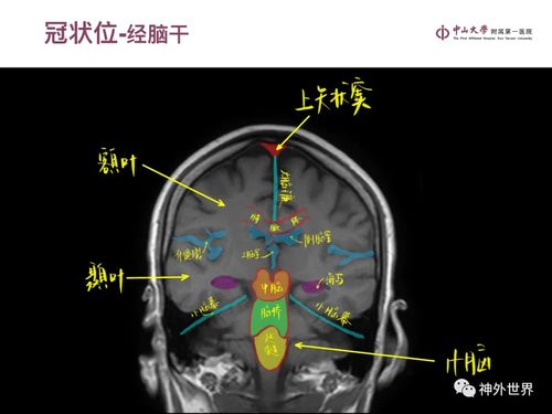 橙光游戏攻略游戏推荐 VS stesam攻略游戏