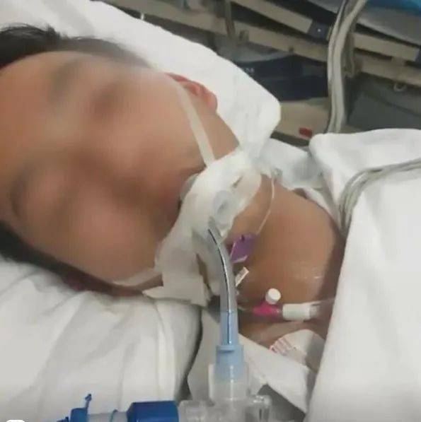 10岁男孩打《拳皇》致掌骨骨折 10岁男孩打《拳皇》致掌骨骨折