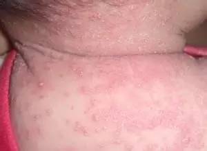 夏天这些病都是省出来的